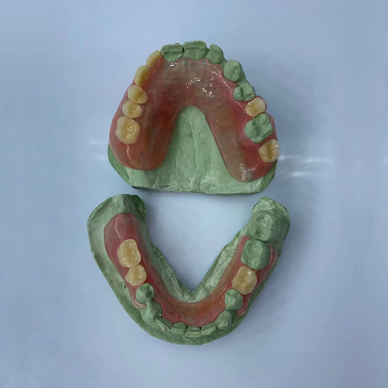 Removable Restoration