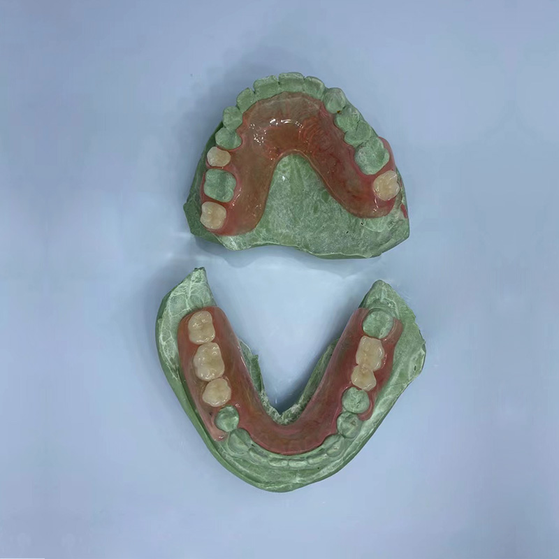 Removable Restoration