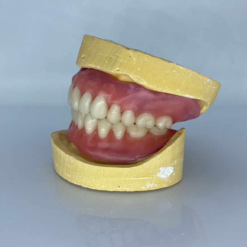 Removable Restoration