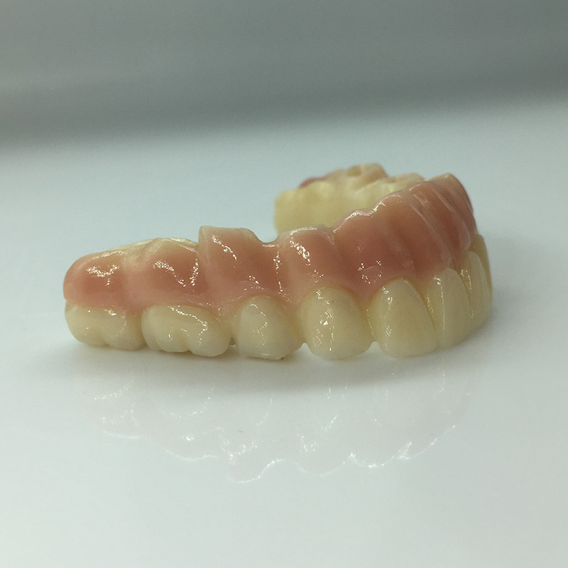 Implant Restoration