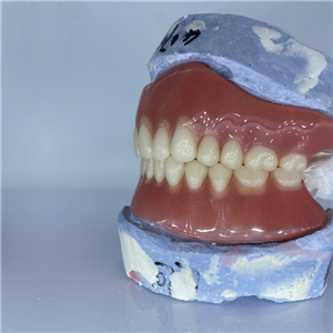 Removable Restoration