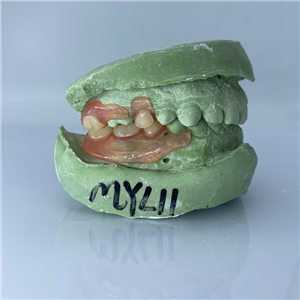 Removable Restoration