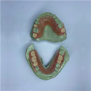 Removable Restoration