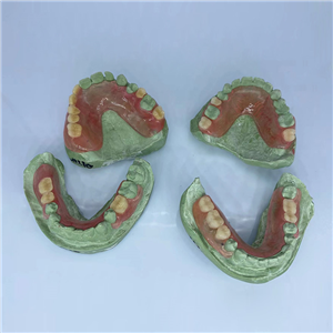 Removable Restoration