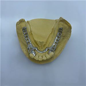 Removable Restoration