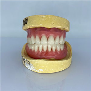 Removable Restoration