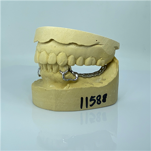 Removable Restoration