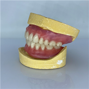 Removable Restoration