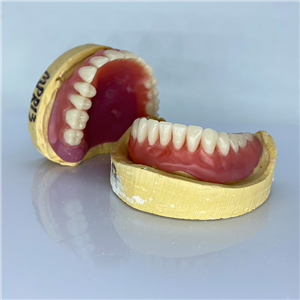 Removable Restoration