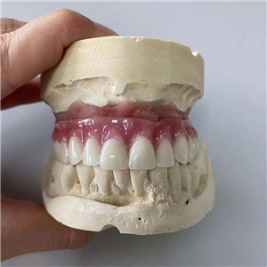 Removable Restoration