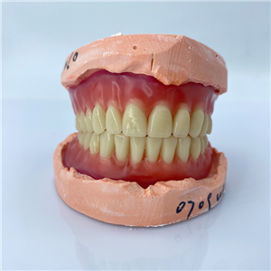 Removable Restoration