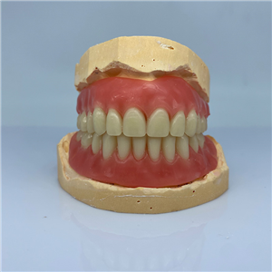 Removable Restoration