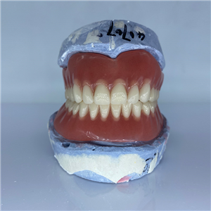 Removable Restoration