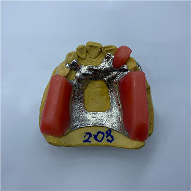 Removable Restoration