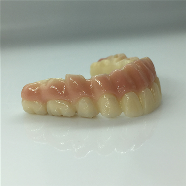 Implant Restoration